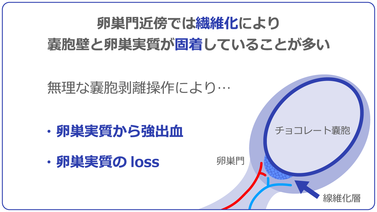 どんな術式が卵巣温存に有効か？