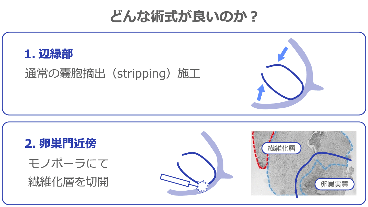 どんな術式が良いのか？